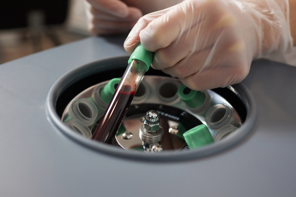 PRP for female arousal